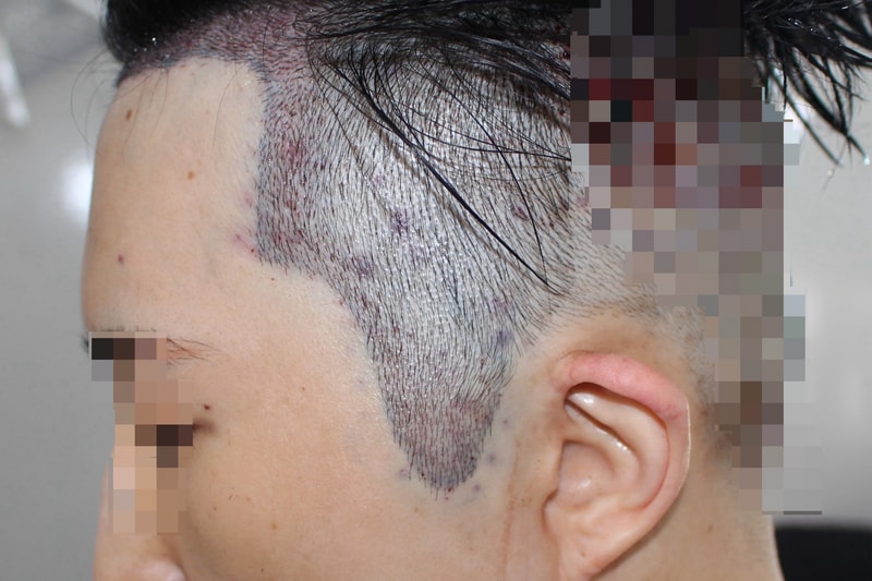 포토후기 이미지