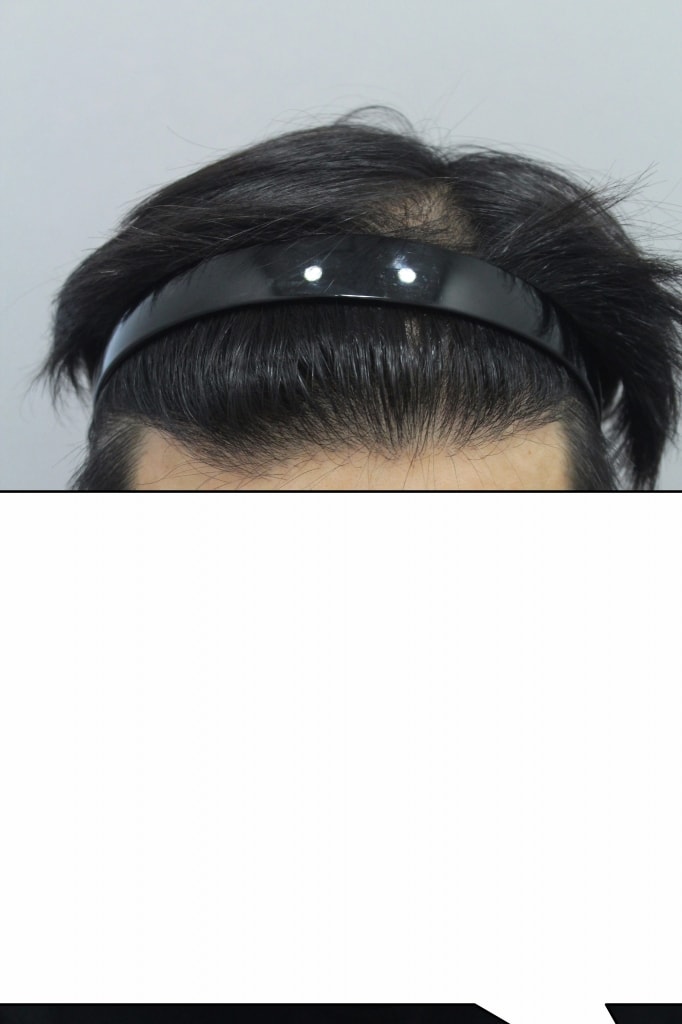 수술후.jpg