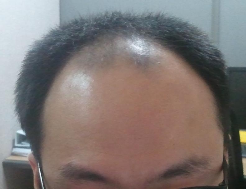 전1.JPG