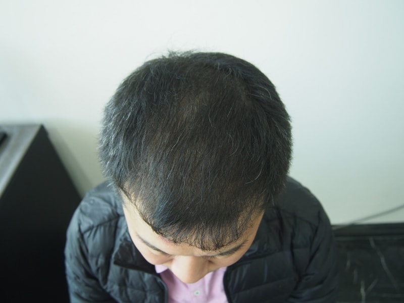 4개월.JPG