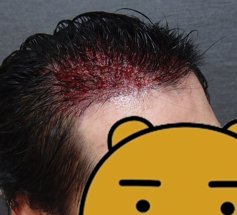 2_수술직후03.jpg