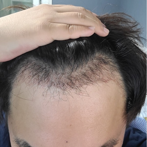 1달_2.jpg