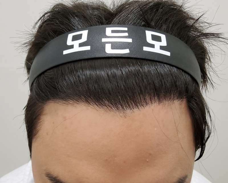 3. 수술후_1년_1.jpg