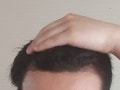 수술후`.jpg