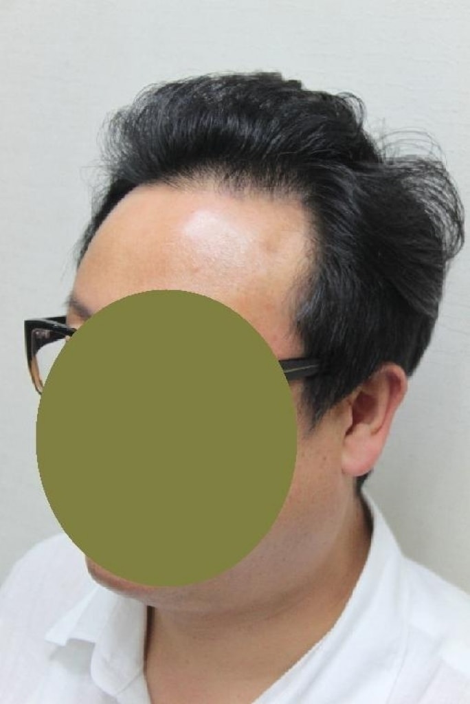 장동석2_9달.JPG
