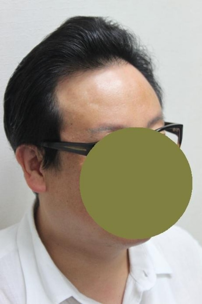 장동석2_9달_(10).JPG