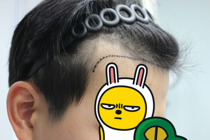 수술 후 우.jpg