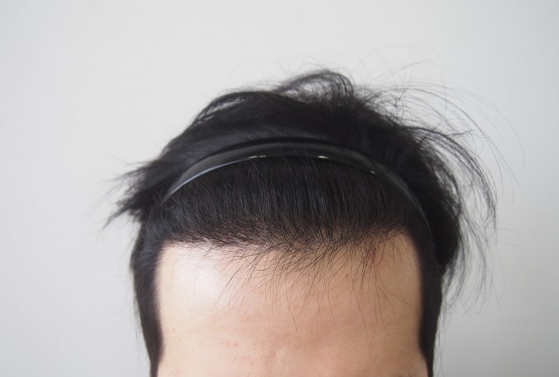 8th Month of Parental Non-Cutting