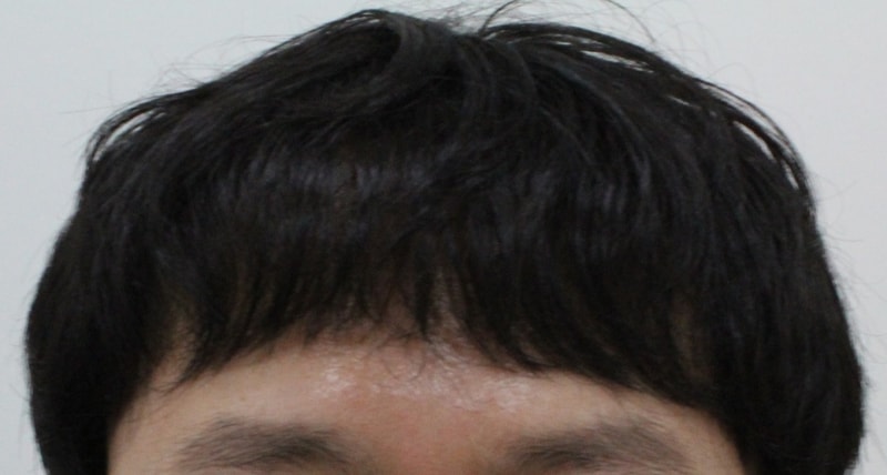 내린머리.jpg