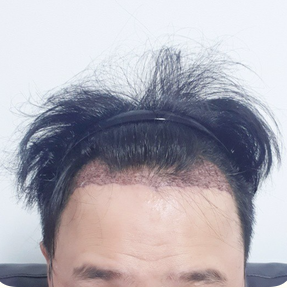 20200612 대다모 후 2.PNG