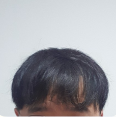 20200612 대다모 후 1.PNG
