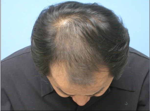 수술직전1.jpg