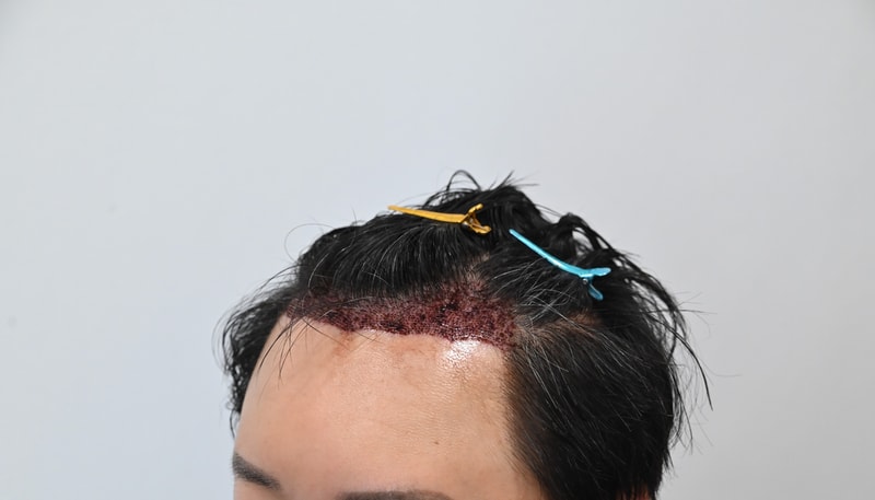 KakaoTalk_20250313_144427230_02.jpg
