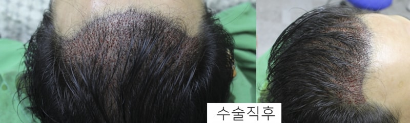 ㅇㅇㅇㅇ.jpg