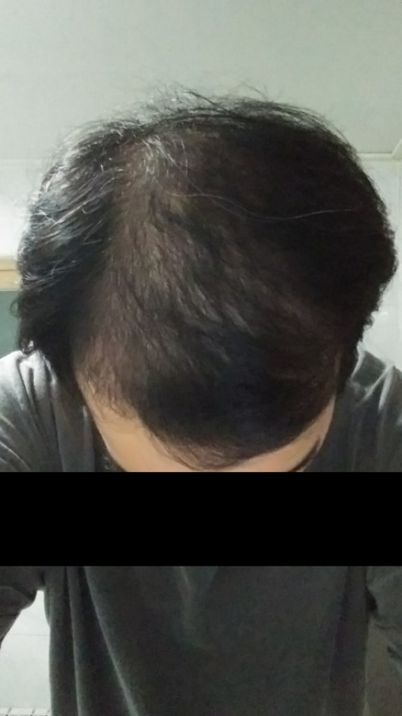 최근.jpg