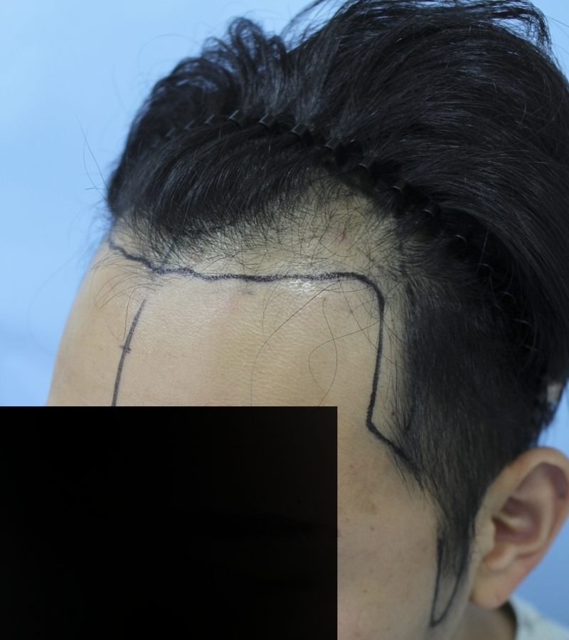 수술디자인02.png