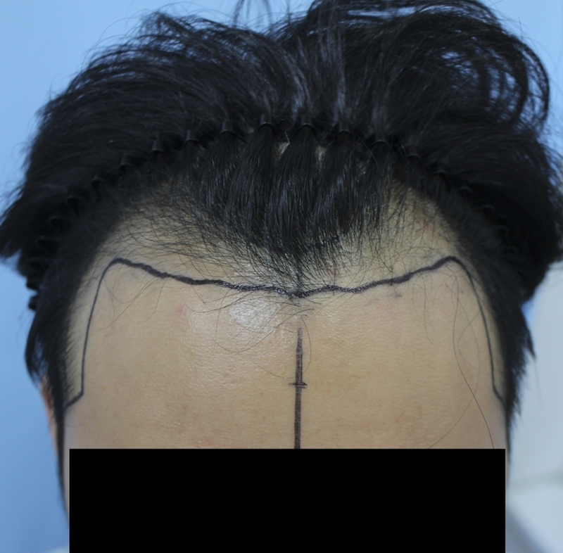 수술디자인01.png
