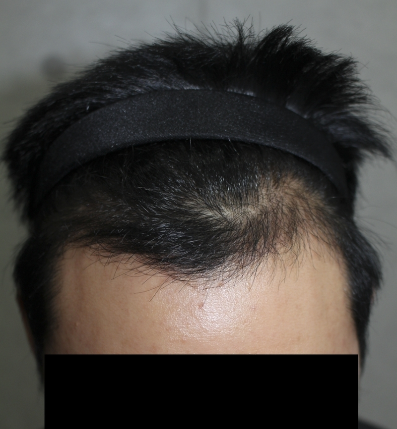 수술후01.png
