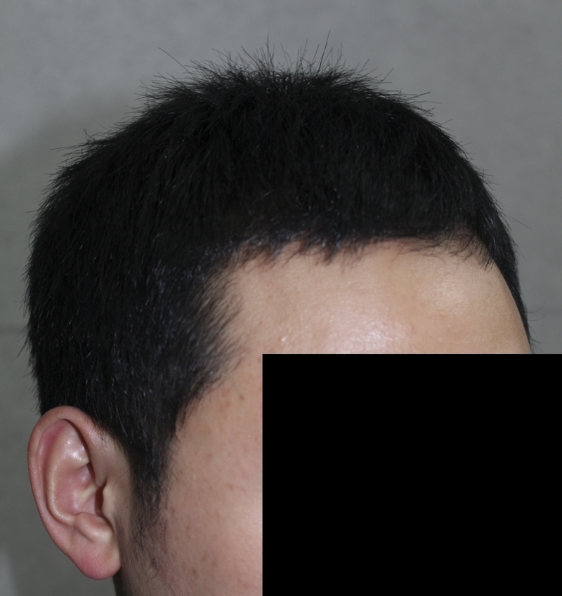 수술후04.png