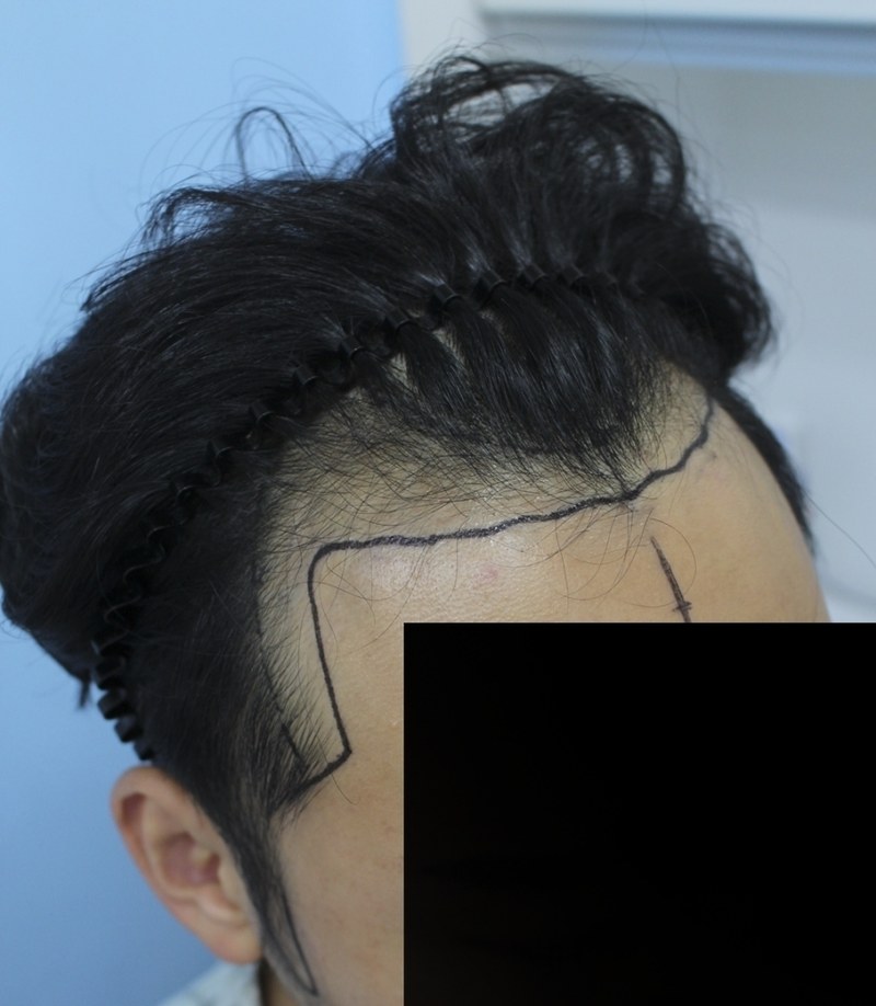 수술디자인03.png