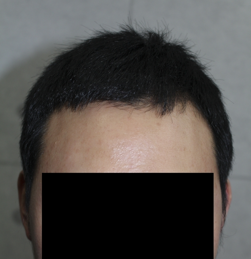 수술후03.png