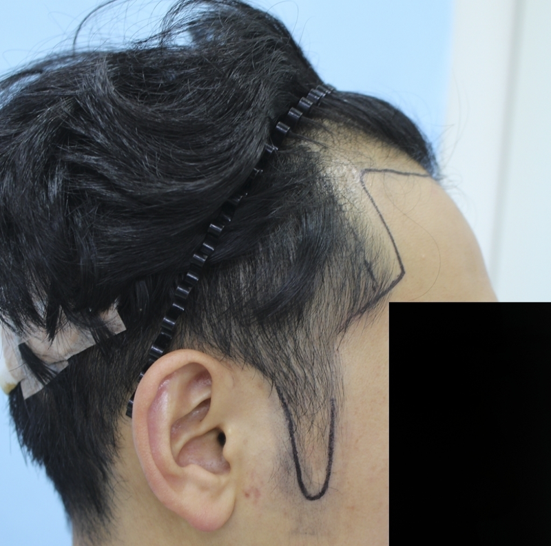 수술디자인04.png