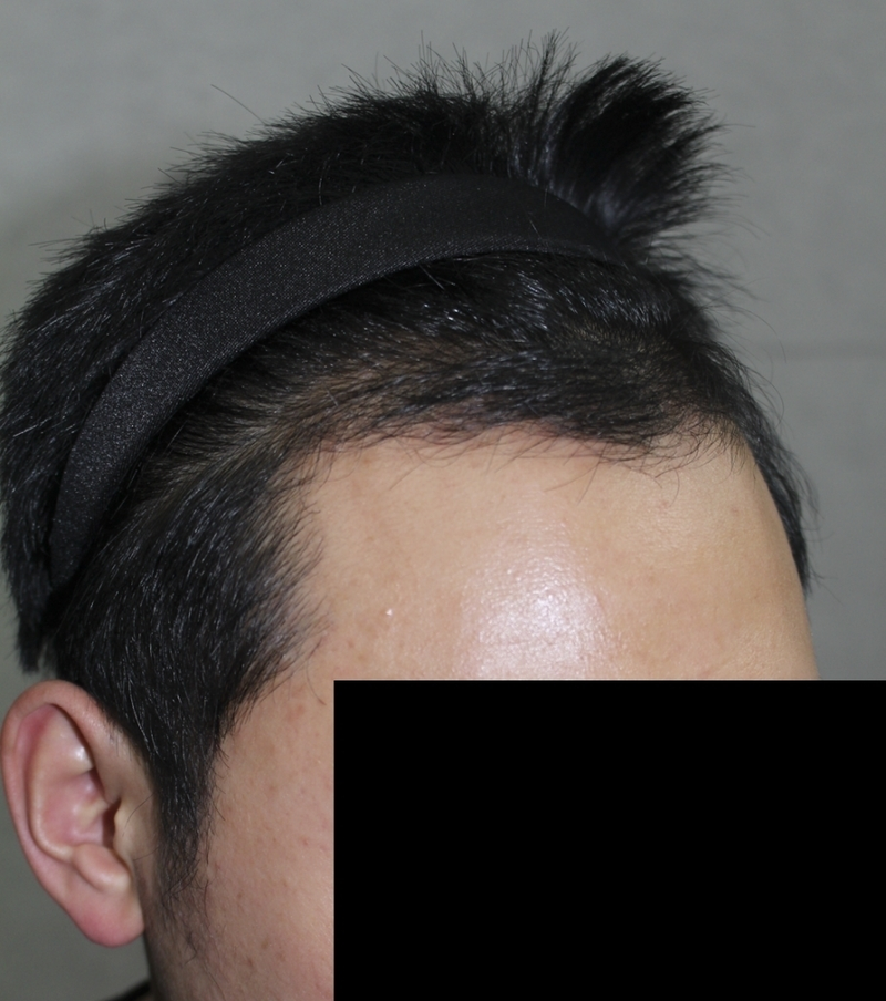 수술후02.png