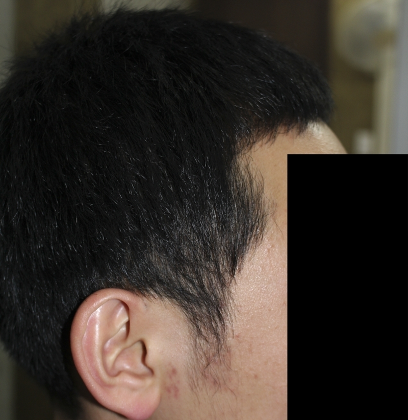 수술후05.png