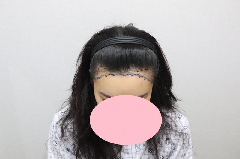 MoPlus Non-Sectionary 1600 Mo 1817 Days Review
