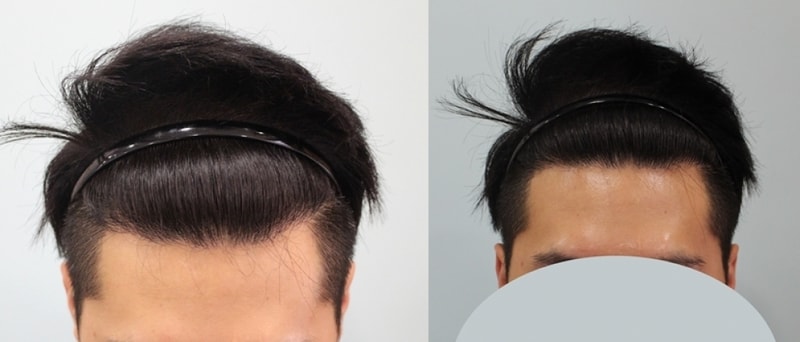 수술후2.jpg