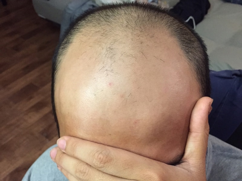 제이피 혼합 6천모 3주 경과 후기입니다