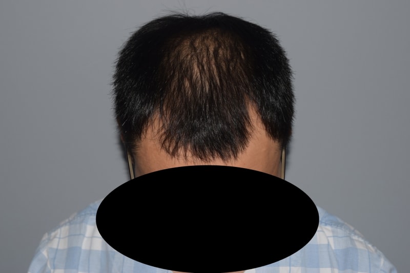 Dana's 10 months of non-cut hair. How is it?