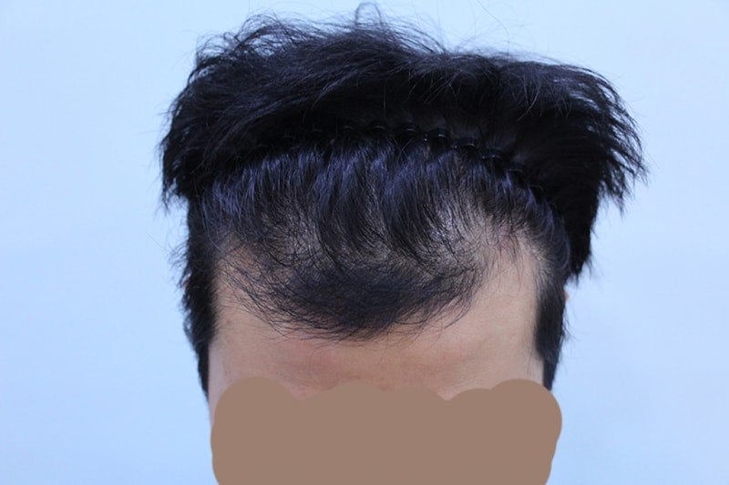 수술전.jpg
