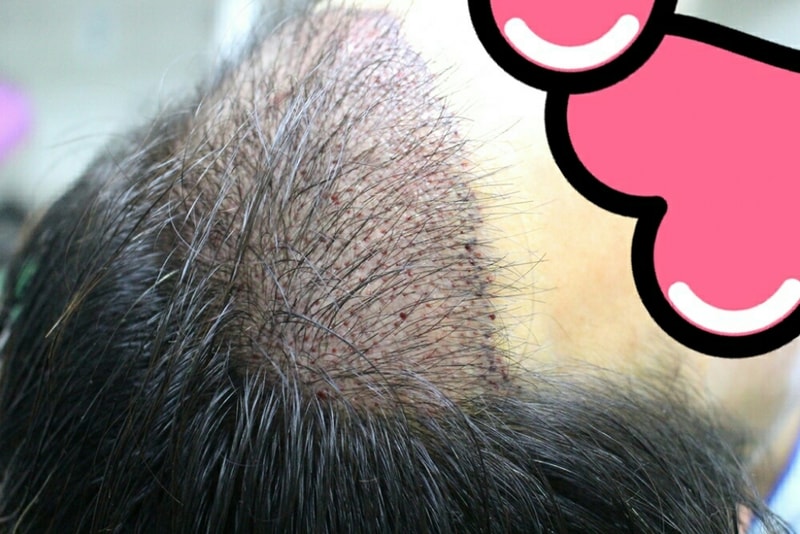 KakaoTalk_20170302_110724551.jpg