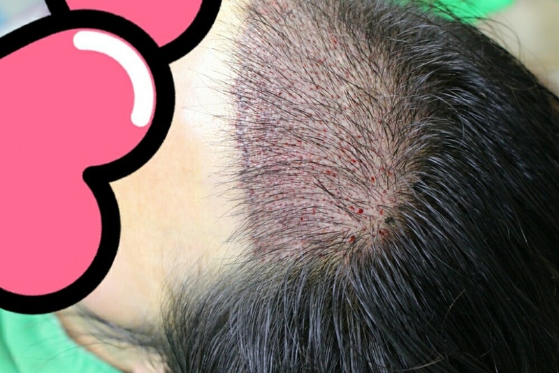 KakaoTalk_20170302_110725191.jpg
