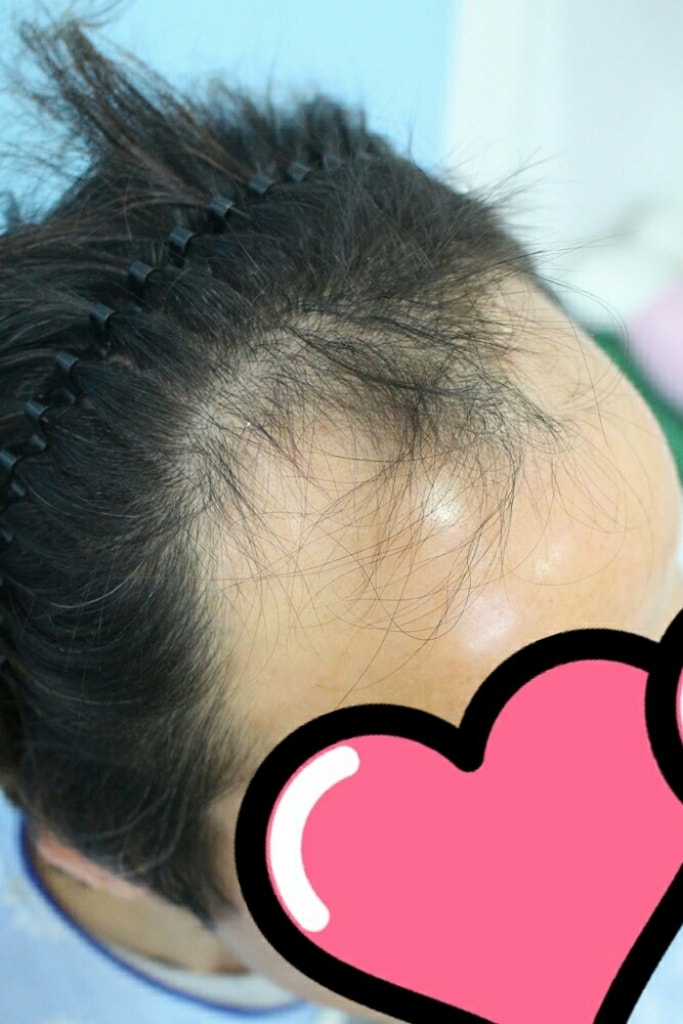 KakaoTalk_20170302_110726263.jpg