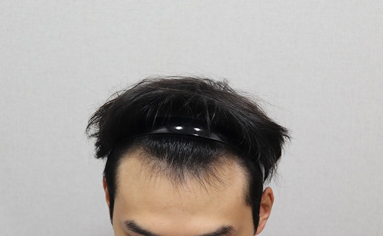 Non-cut 2700 Mo 6 months review