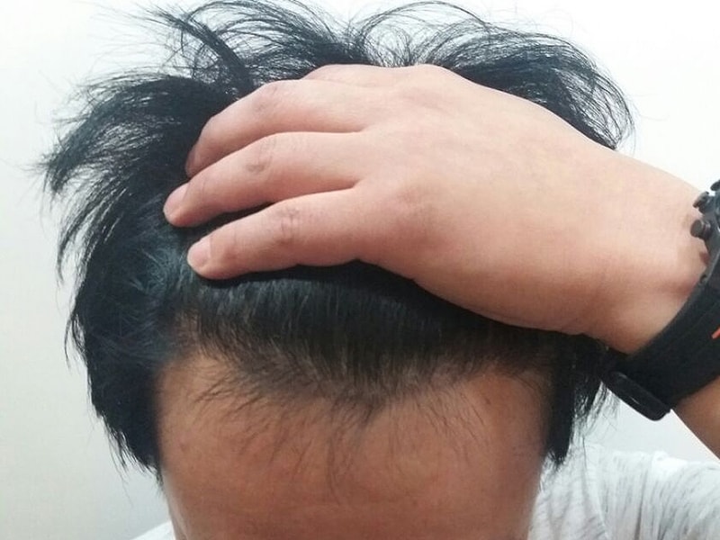 5개월후.jpg