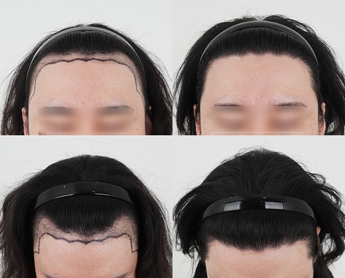 포토후기 이미지