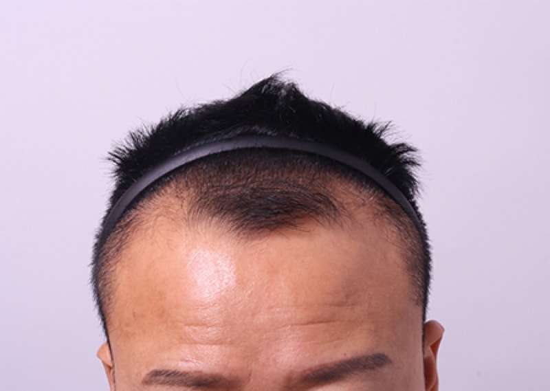 전1.jpg