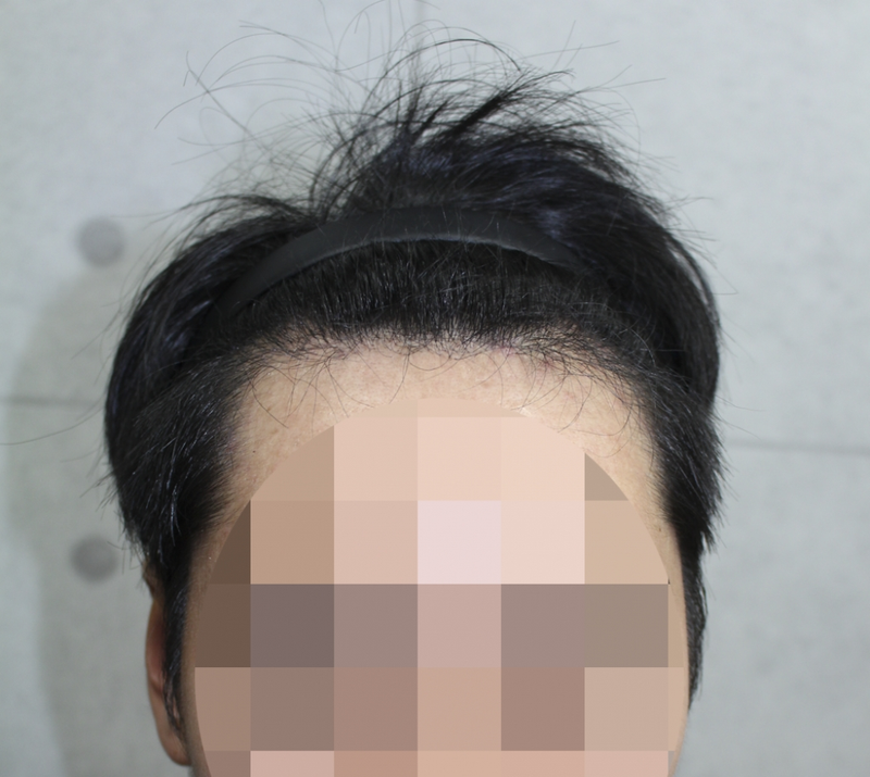 IMG_4209_9개월.png