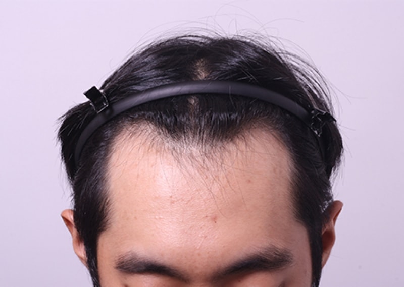 전1.jpg