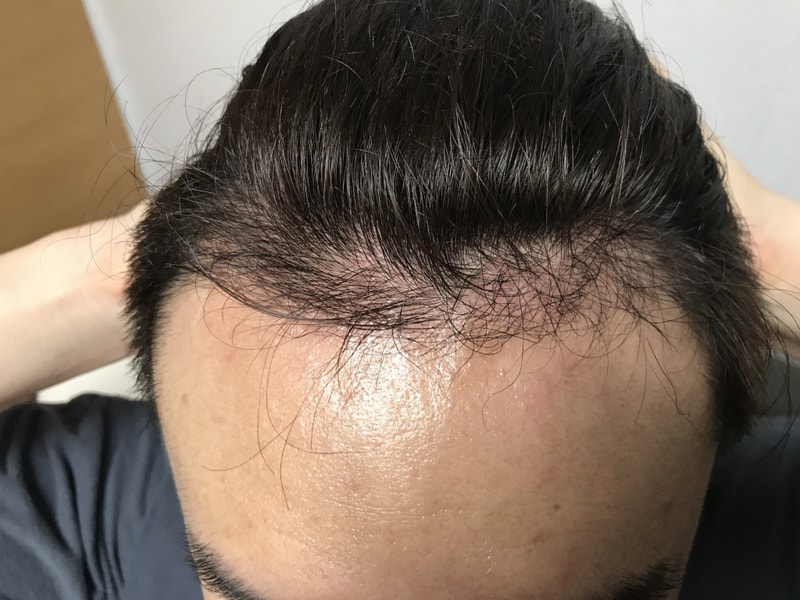 KakaoTalk_20170828_074339556.jpg