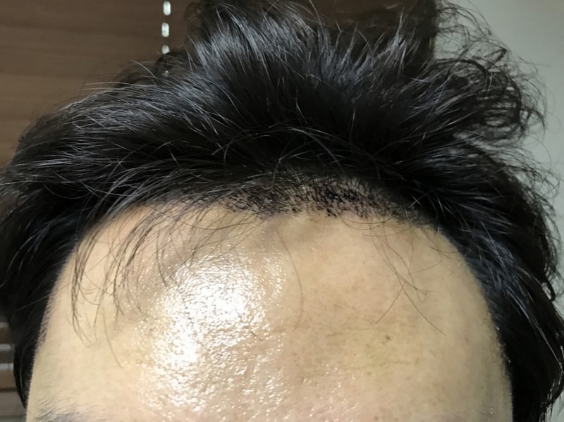 정면.jpg
