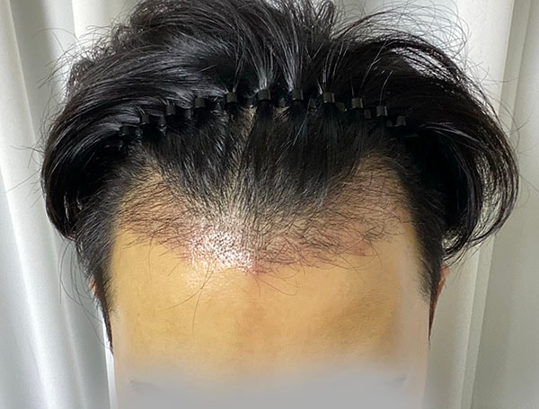 1개월.jpg