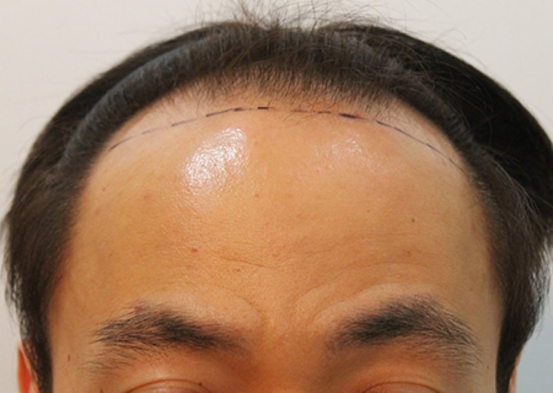수술전1.jpg