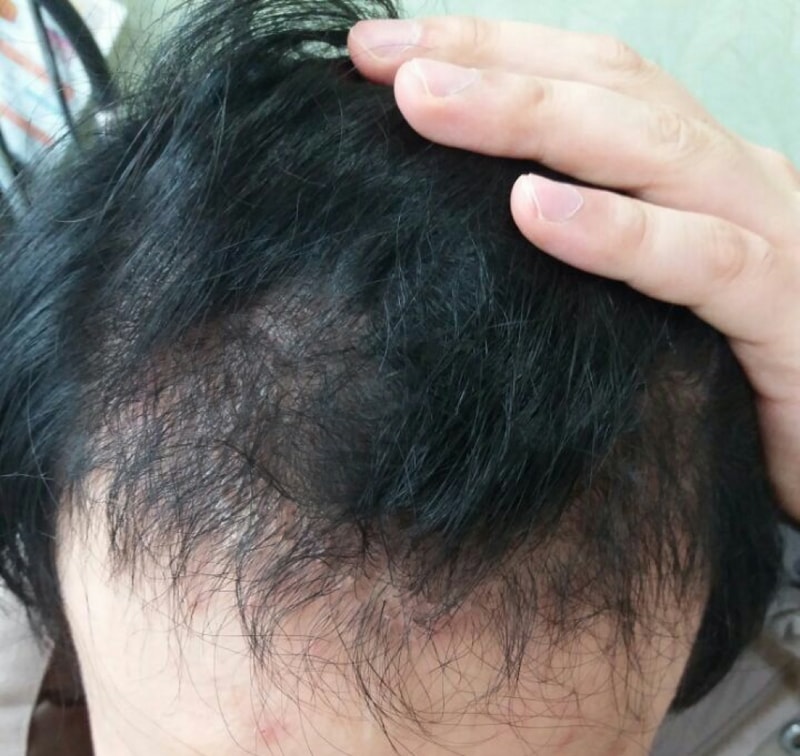 4개월.jpg