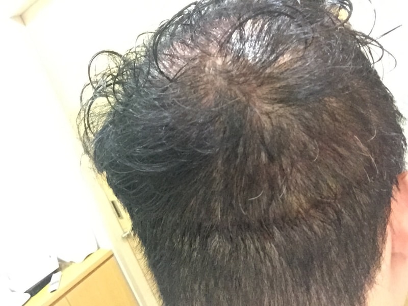 KakaoTalk_20150303_174207866.jpg