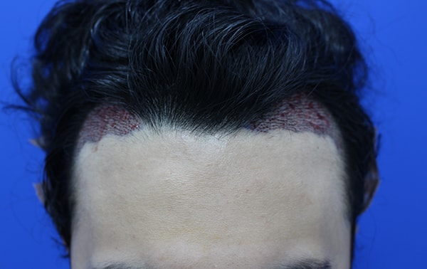 3.JPG