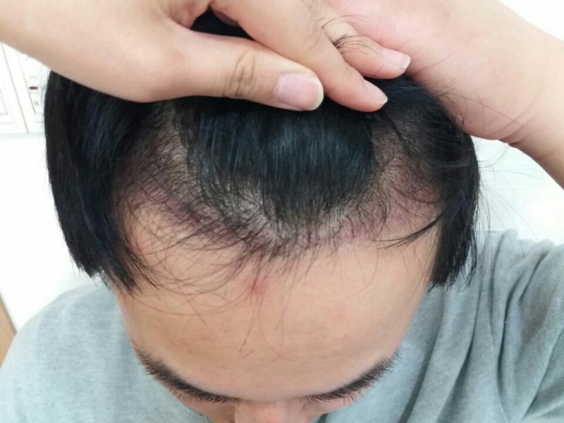 2개월이후.jpg